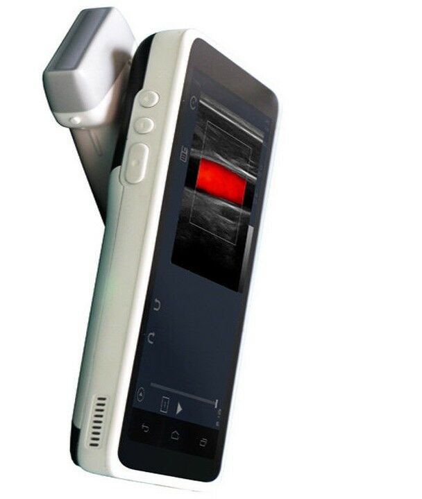 Pocket Size Color Doppler Smart Phone&Linear Array probe 5-10 MHz  6