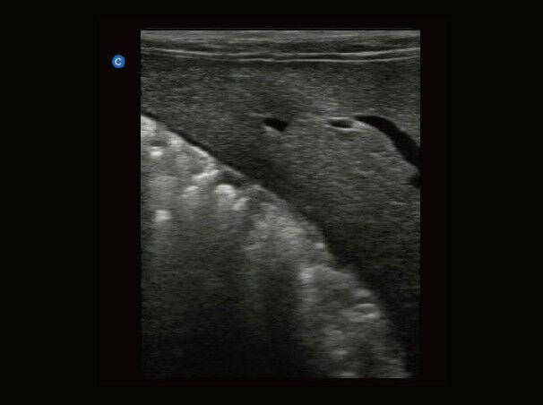 
                  
                    Chison eBit50Vet Veterinary Software Color Doppler High End Portable Ultrasound
                  
                