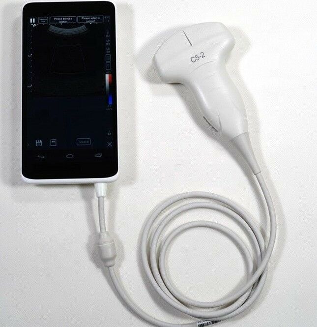 Smart Phone Ultrasound with Convex probe 2.5-5.0 MHz Pocked Size Touchscreen