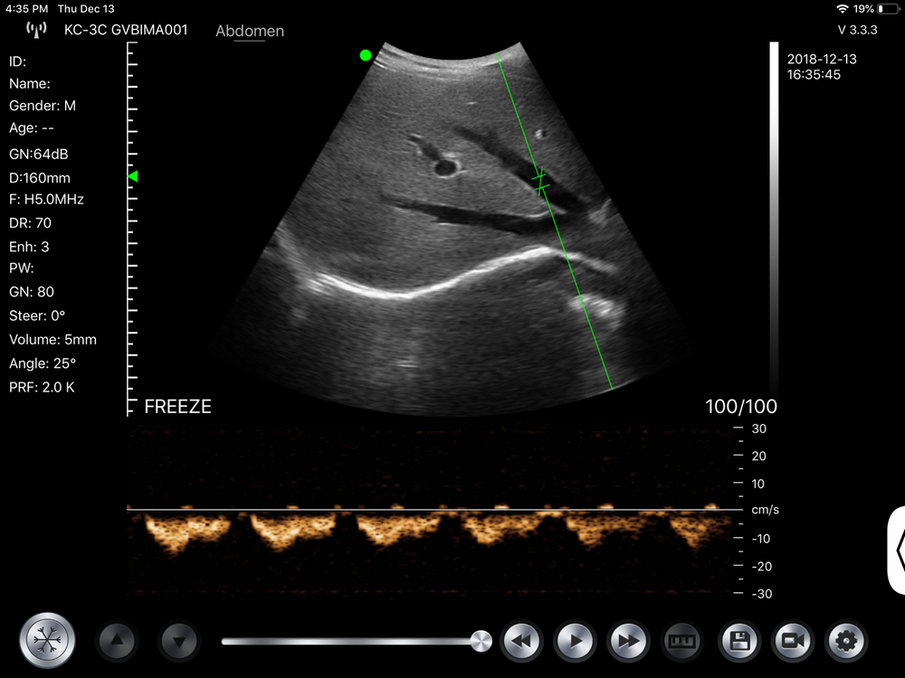 
                  
                    Wireless Fetal Doppler Convex Probe Veterinary Ultrasound for iPad, iPhone App
                  
                