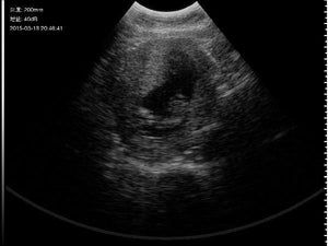 
                  
                    Wireless Sector ultrasound probe working on Smart Phone-Cordless-Veterinary
                  
                