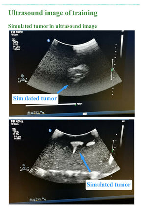 
                  
                    Model for Interventional Ultrasound, Soft tissue, B-Ultrasound Training Teaching
                  
                