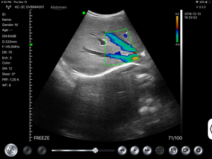 
                  
                    Wireless Fetal Doppler Convex Probe Veterinary Ultrasound for iPad, iPhone App
                  
                