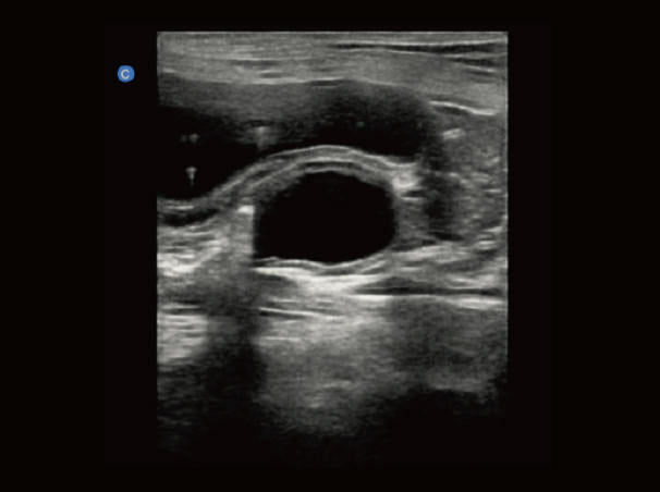 
                  
                    Chison eBit50Vet Veterinary Software Color Doppler High End Portable Ultrasound
                  
                