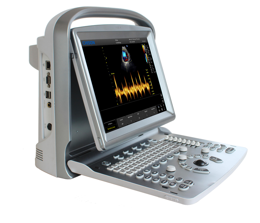 
                  
                    Demo Chison ECO5Vet Portable Ultrasound with One Probe - Warranty Active
                  
                