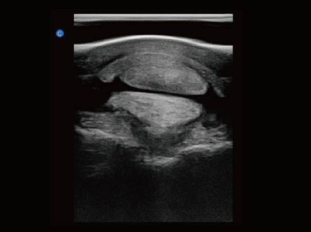 
                  
                    Chison eBit50Vet Veterinary Software Color Doppler High End Portable Ultrasound
                  
                