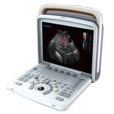 
                  
                    Chison Q5 with 4D Ultrasound, Advanced Color Doppler | KeeboMed
                  
                