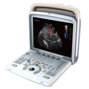 
                  
                    Chison Q5 with 4D Ultrasound, Advanced Color Doppler | KeeboMed
                  
                
