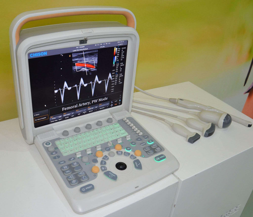 
                  
                    Chison Q5Vet Ultrasound for Veterinary | KeeboMed
                  
                