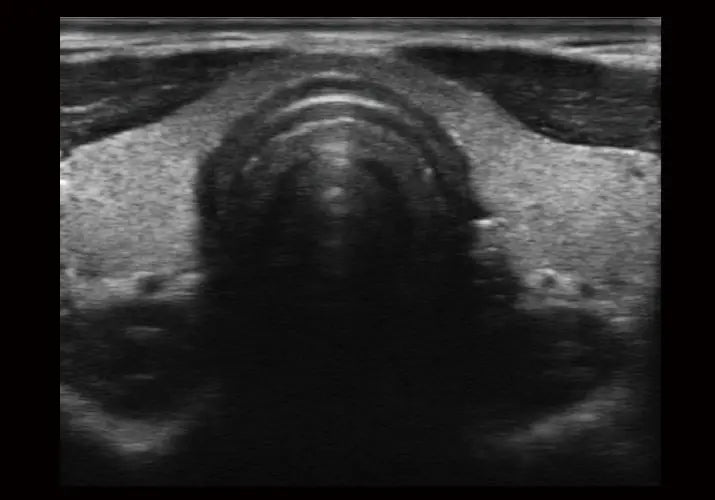 
                  
                    SonoScape E1 Exp Ultrasound
                  
                