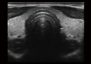 
                  
                    SonoScape E1 Exp Ultrasound
                  
                