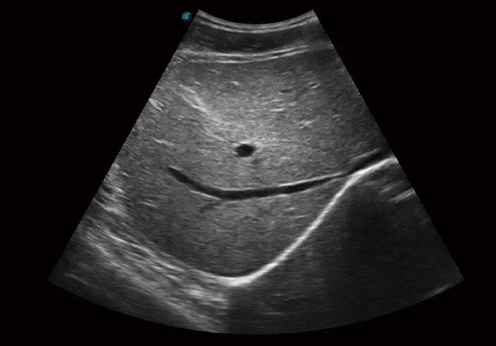 
                  
                    SonoScape E1 Exp Ultrasound
                  
                