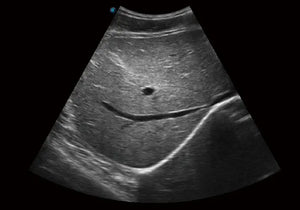 
                  
                    SonoScape E1 Exp Ultrasound
                  
                