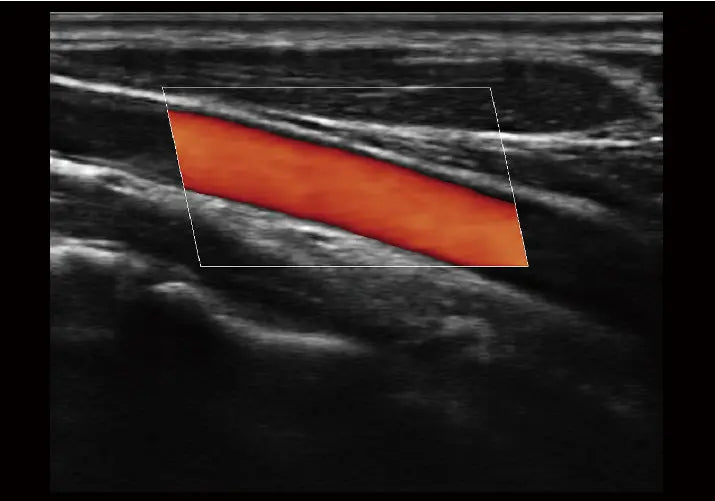 
                  
                    SonoScape E1 Exp Ultrasound
                  
                