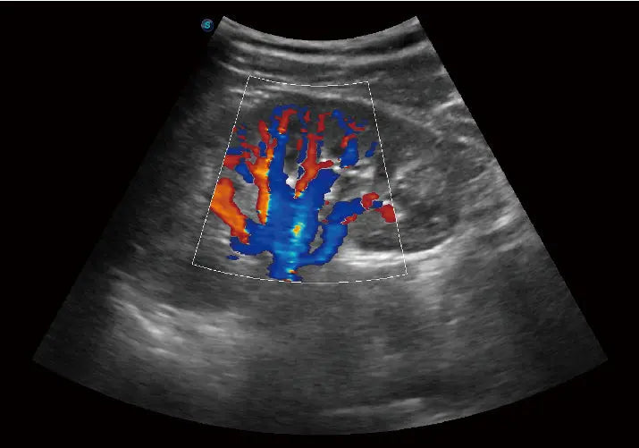 
                  
                    SonoScape E1 Exp Ultrasound
                  
                