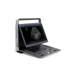 
                  
                    SonoScape E1 Black & White Human Ultrasound | KeeboMed
                  
                