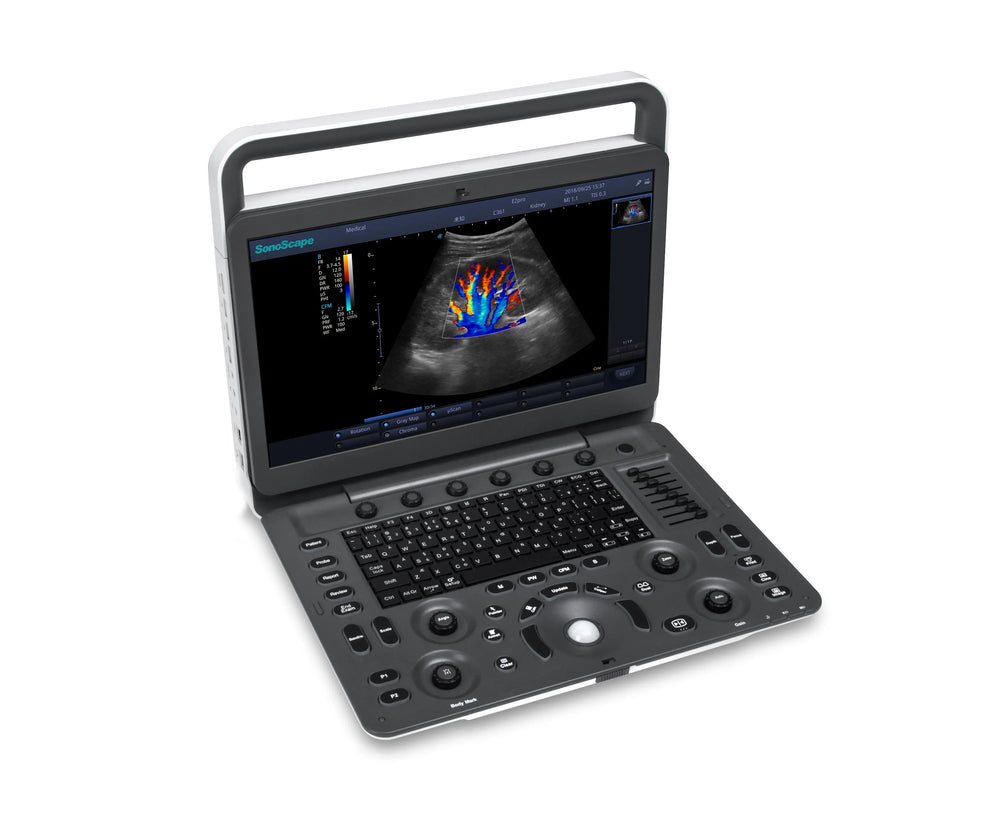 SonoScape E2 Portable Color Doppler