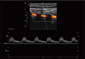 
                  
                    SonoScape E2 Portable Color Doppler
                  
                