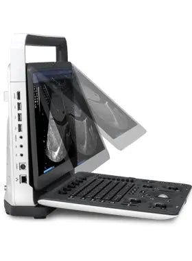 SonoScape E3 Color Doppler