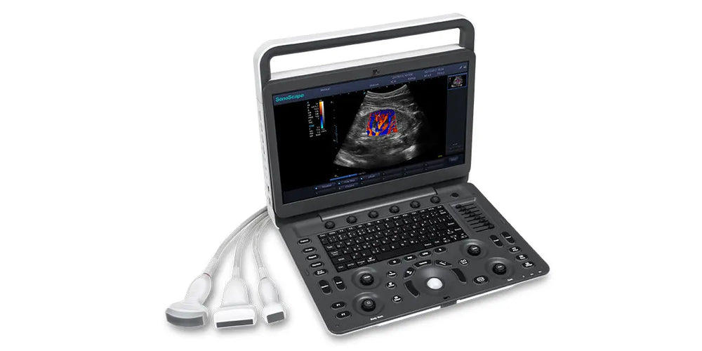 
                  
                    SonoScape E3 Color Doppler
                  
                