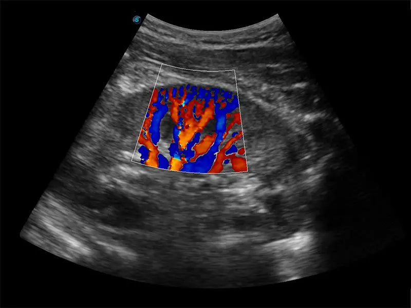 
                  
                    SonoScape E3 Color Doppler
                  
                