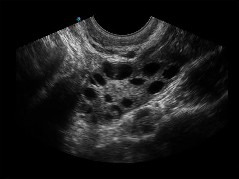 
                  
                    SonoScape E3 Color Doppler
                  
                
