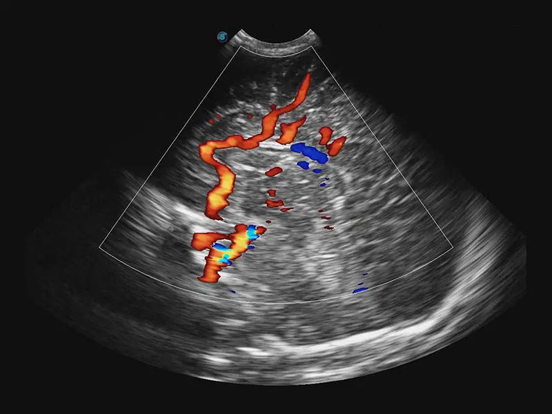 
                  
                    SonoScape E3 Color Doppler
                  
                