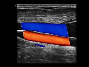 
                  
                    SonoScape E3 Color Doppler
                  
                