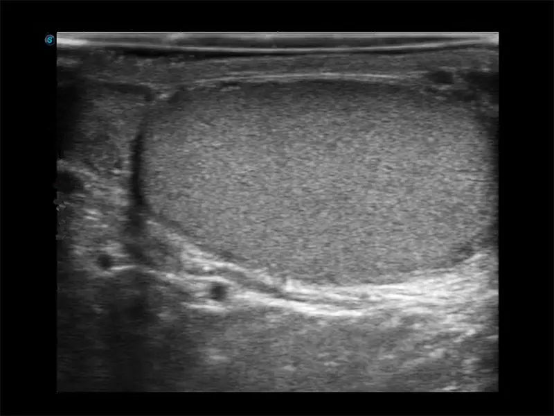 
                  
                    SonoScape E3 Color Doppler
                  
                