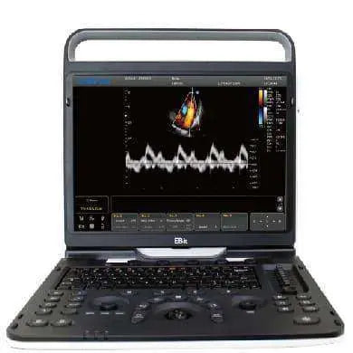 Chison EBit 60 | KeeboMed Color Doppler Ultrasound