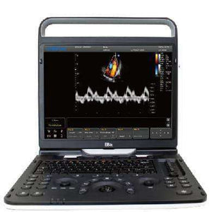 
                  
                    Chison Ebit 60 Color Doppler Ultrasound Machine for Sale
                  
                