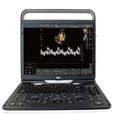 Chison EBit 60 Vet Advanced Veterinary Ultrasound | KeeboMed