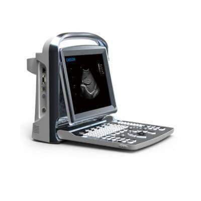 Chison ECO1 Black & White Ultrasound 