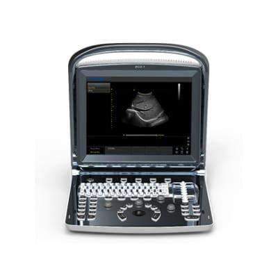 
                  
                    Affordable Chison ECO1 Ultrasound
                  
                