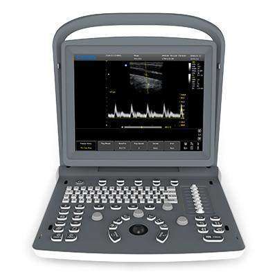 
                  
                    Chison ECO2 on Sale- By Emails
                  
                