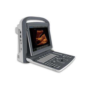 
                  
                    Chison ECO2 Ultrasound
                  
                