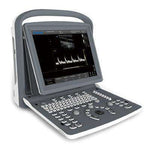 Chison ECO2 on Sale- By Emails