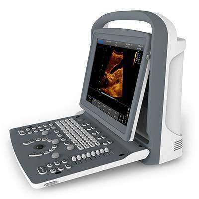 
                  
                    Chison ECO2 Ultrasound | Optimized Images
                  
                