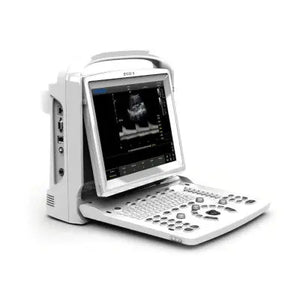 
                  
                    Chison ECO 3 Quality Black & White Ultrasound Machine
                  
                