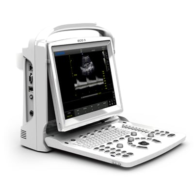 Chison ECO3 Expert Ultrasound