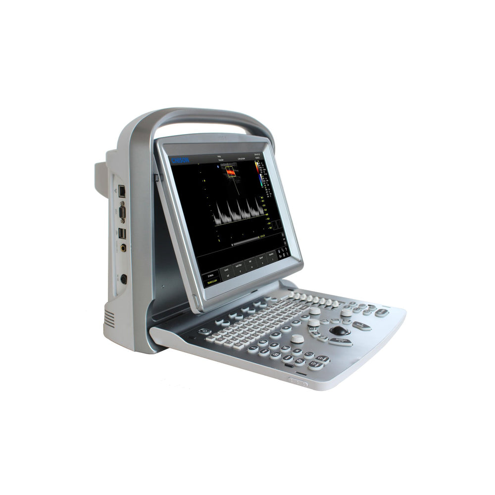 Chison ECO5Vet Advanced Image Ultrasound | KeeboMed