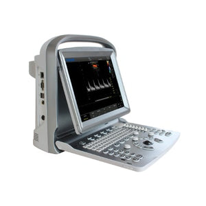 
                  
                    Chison ECO5 Color Doppler Ultrasound
                  
                