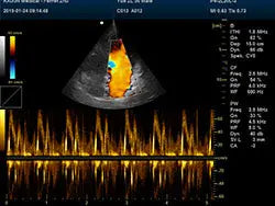 
                  
                    DCU 30 Color Doppler Veterinary Ultrasound
                  
                