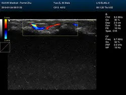 
                  
                    DCU30 Vet Compact Ultrasound | KeeboMed
                  
                