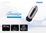 Chison SonoEye P6 VET Micro-Convex | KeeboMed Ultrasound Machines