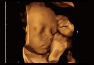 
                  
                    KZ60 Affordable Color Doppler Ultrasound | KeeboMed
                  
                