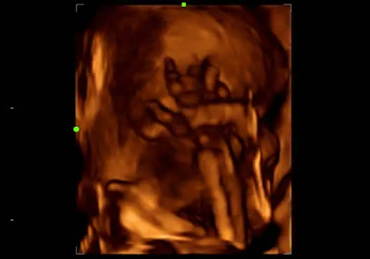 
                  
                    KZ60 Affordable Color Doppler Ultrasound | KeeboMed
                  
                