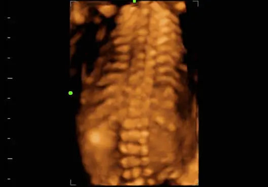 
                  
                    KZ60 Affordable Color Doppler Ultrasound | KeeboMed
                  
                