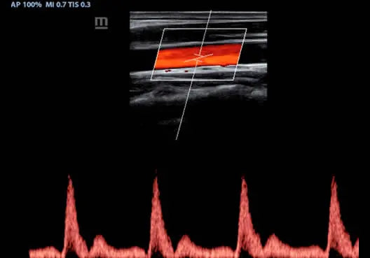 
                  
                    KZ60 Affordable Color Doppler Ultrasound | KeeboMed
                  
                