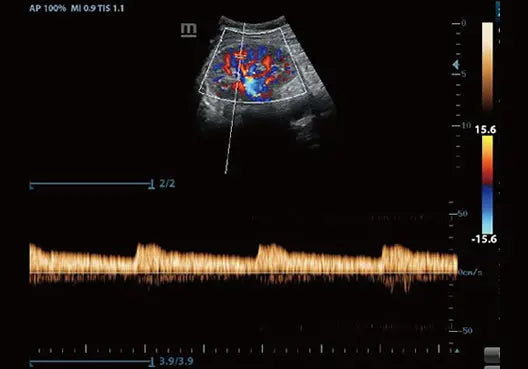 
                  
                    KZ60 Affordable Color Doppler Ultrasound | KeeboMed
                  
                